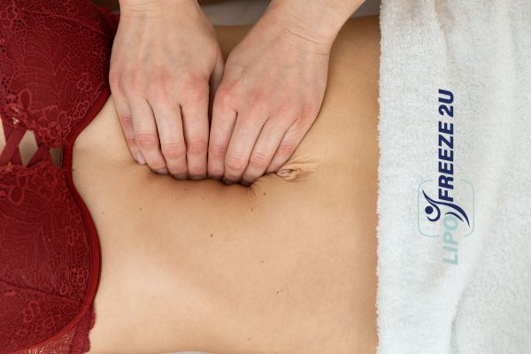 diastasis recti treatment Wales