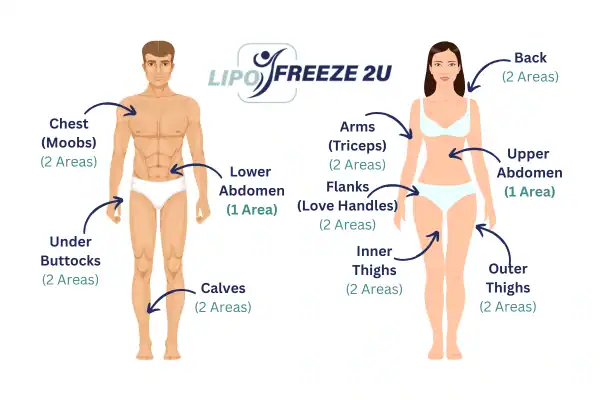 Areas you can have fat freezing treatment Wales
