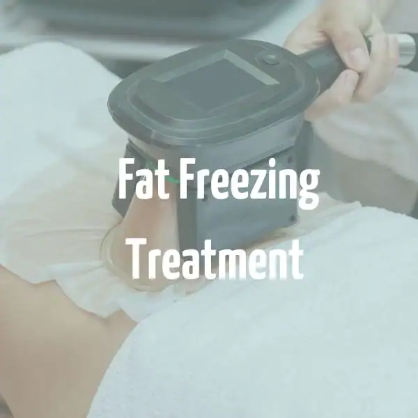 fat freezing treatment Wales