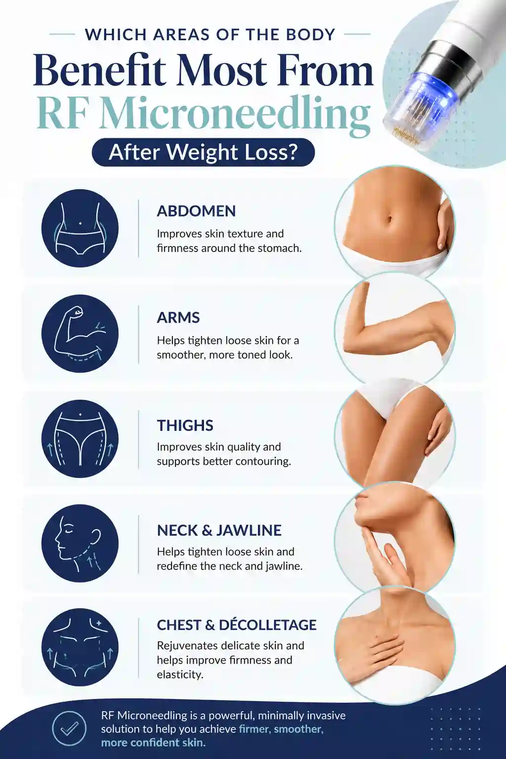 Which Areas of the Body Benefit Most From RF Microneedling After Weight Loss Wales